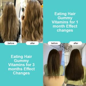 Alternative view of Hair vitamin gummies